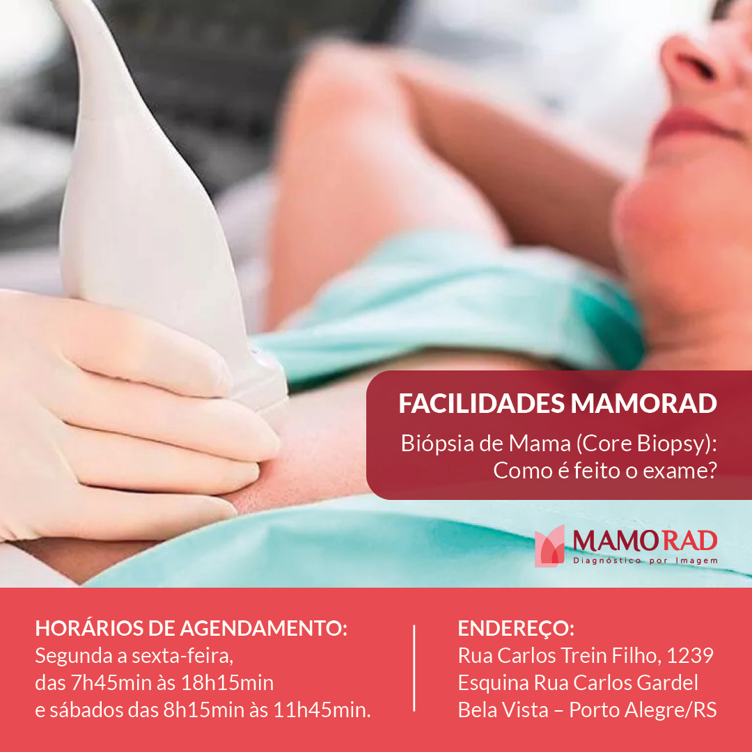 Card-facilidades-mamorad-biopsia-de-mama.jpg