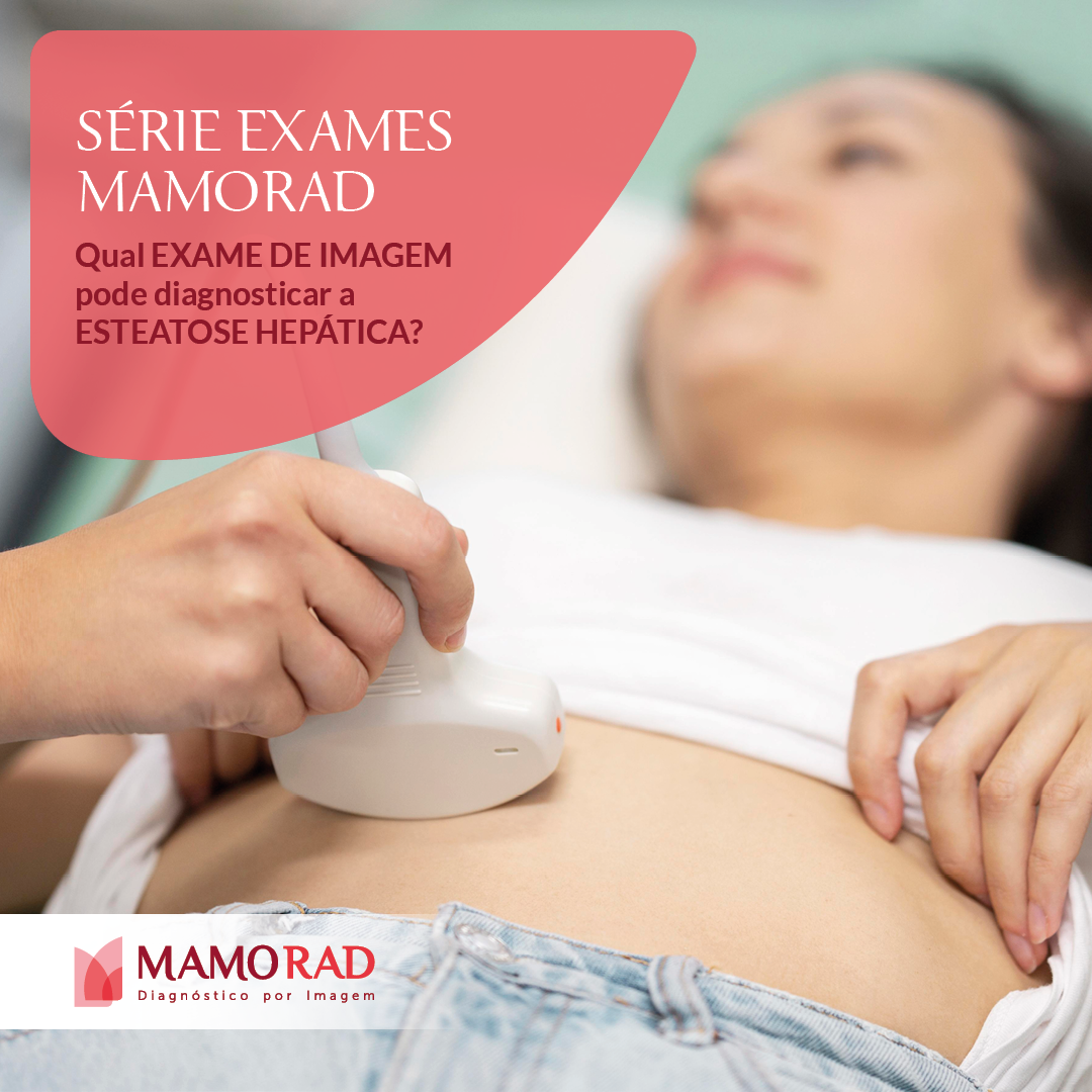 Card-serie-exames-mamorad-esteatose-hepatica.png