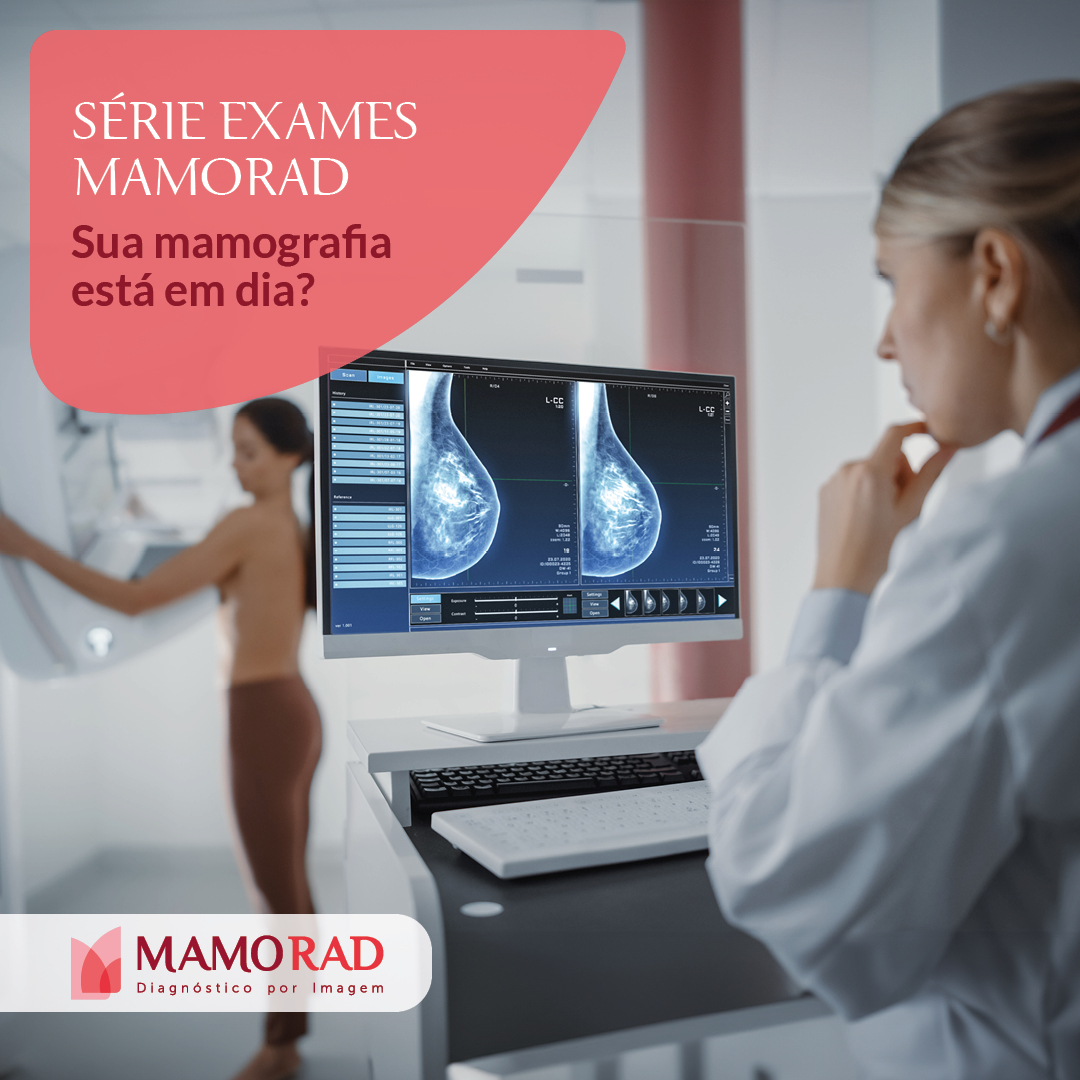 Card-serie-xames-mamografia-em-dia.jpg