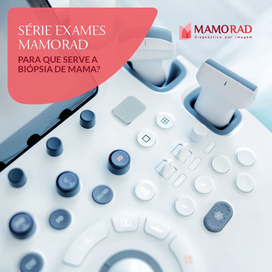 Card-serie-exames-biopsia-mama.jpg