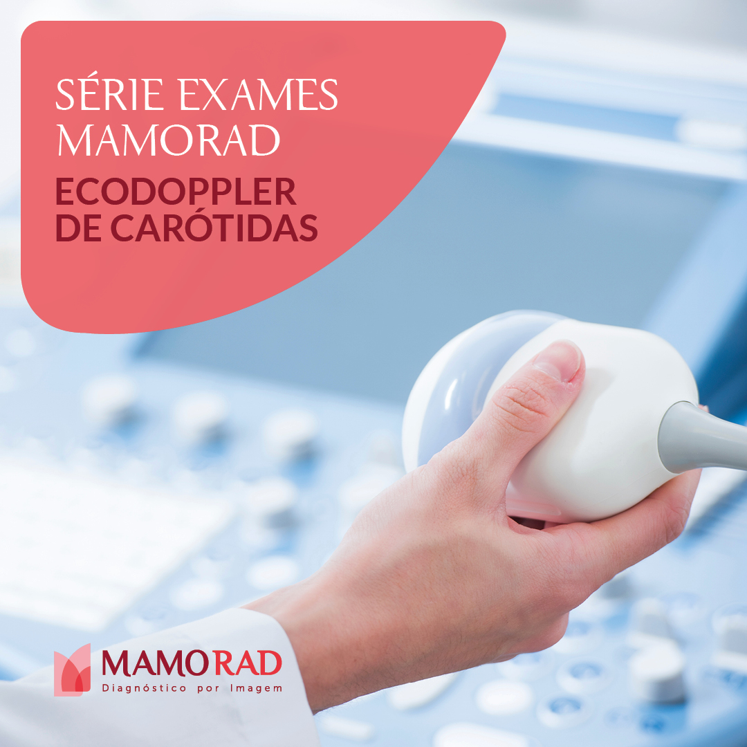 Card-serie-exames-ecodoppler-carotida.jpg