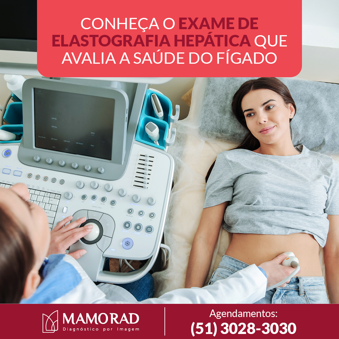 Card-conheca-elastografia.jpg