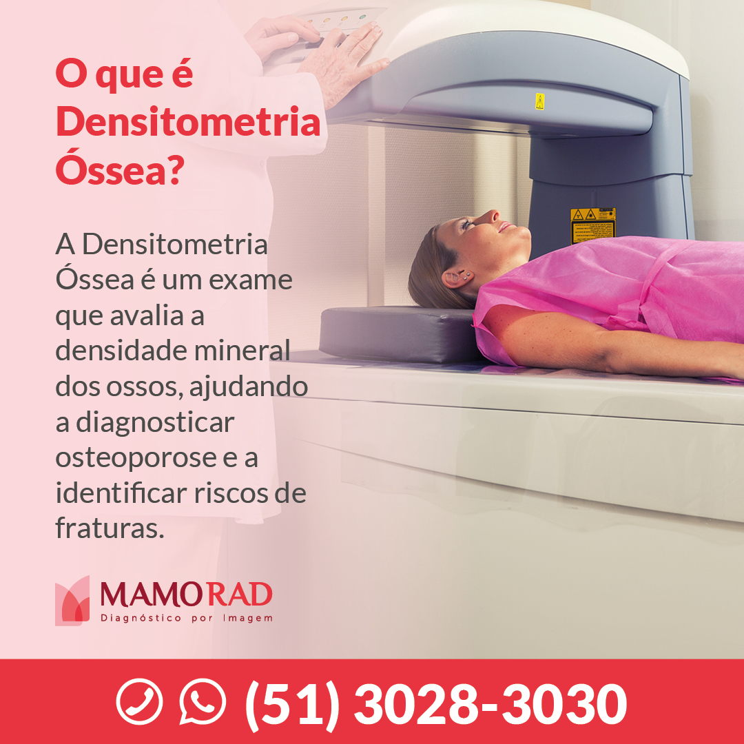 Cards-oque-e-densitometria-ossea-1-SITE.jpg
