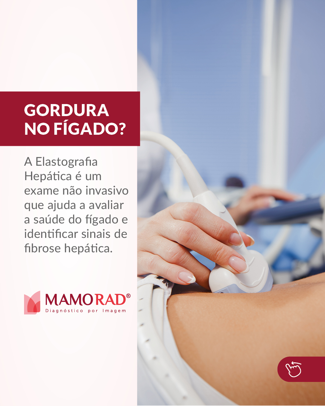 Card-gordura-no-figado-mamorad-1.jpg