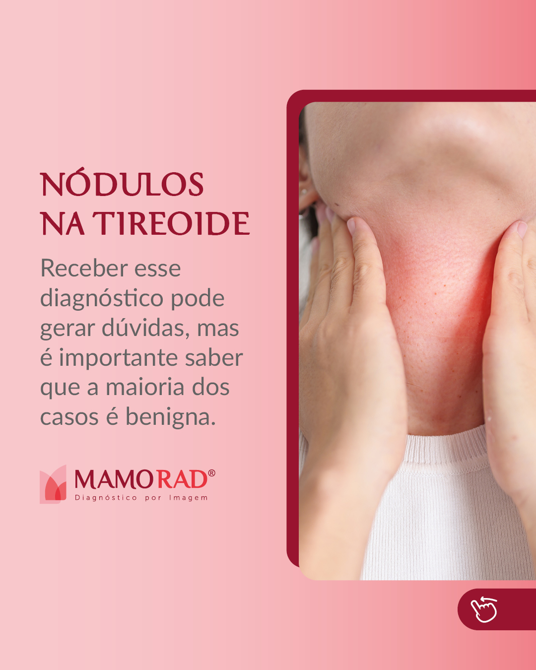 Card-nódulos-na-tireoide-1.jpg