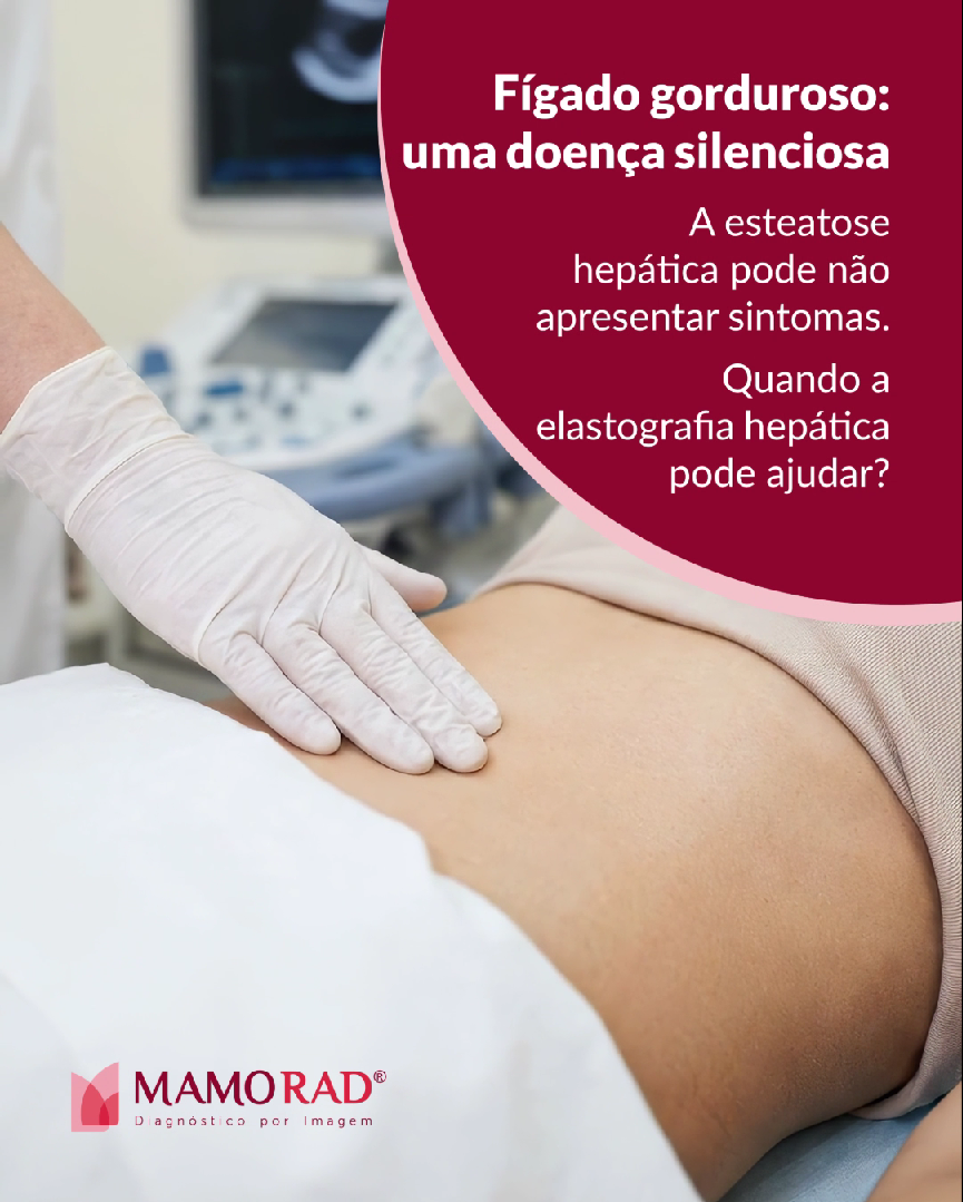 esteatose-hepatica-1-site.png